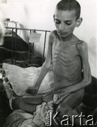 1942, Wrewskoje, Uzbekistan, ZSRR.
Wygłodzone polskie dziecko siedzi na szpitalnym łóżku.
Fot. NN, zbiory Instytutu Józefa Piłsudskiego w Londynie