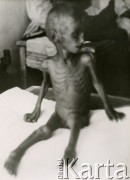 1942, ZSRR.
Wychudzony chłopiec siedzący na szpitalnym łóżku.
Fot. NN, zbiory Ośrodka KARTA, Pogotowie Archiwalne [PAF_033], udostępnił Piotr Balcer
